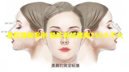 曼陀隆胸案例 曼陀假体隆胸250大不大